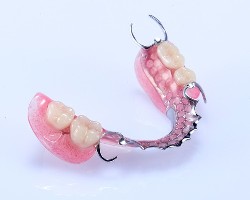 活动假牙的护理方法，你知道多少？